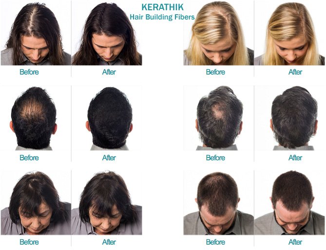 kerathik hair fiber before and after